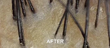 Anti-Dandruff Without Dryness