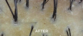 Scalp-First Cleansing