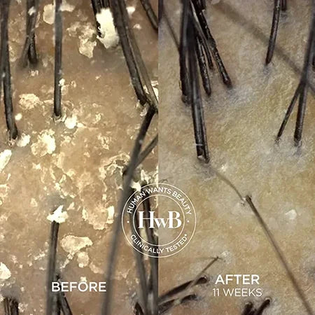 THE PRE-SHAMPOO SCALP WHIP CREAM