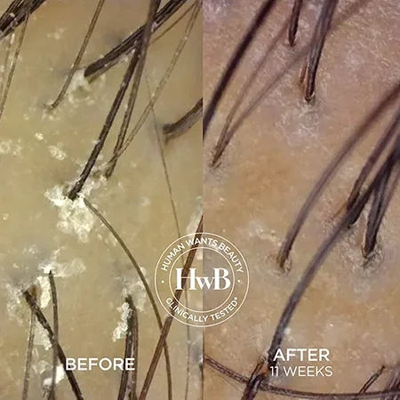 THE HWB SCALP RESET DUO