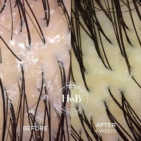 THE SCALP RESET DUO + SCALP MASSAGE COMB