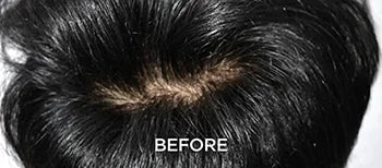 Weak Roots, Ongoing Hair Fall