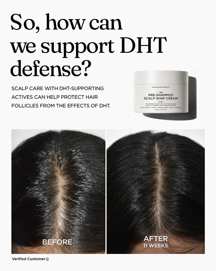 The Pre-Shampoo Scalp Whip Cream powered by DHT-supporting actives for healthier-looking hair and scalp