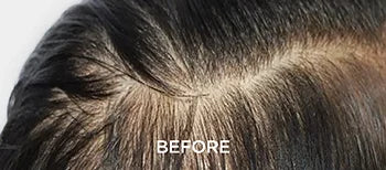 Root Care Often Gets Missed