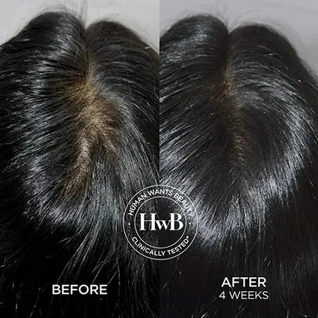 THE HWB SCALP SUPREME SET