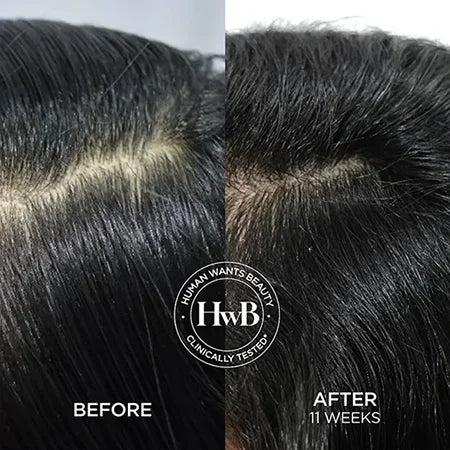 THE HOLD THE HAIRLINE BIOTIN SHAMPOO