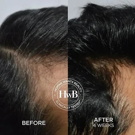 THE HWB SCALP RESET DUO
