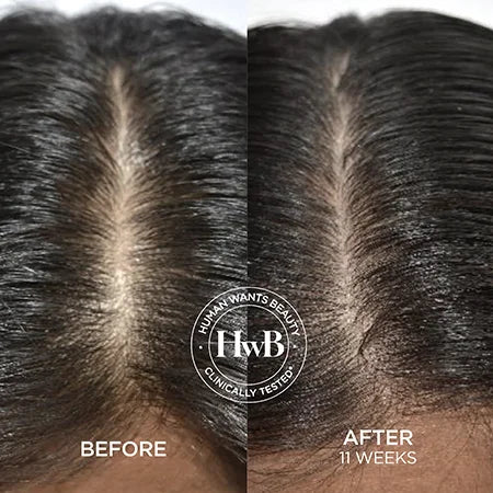 THE PRE-SHAMPOO SCALP WHIP CREAM