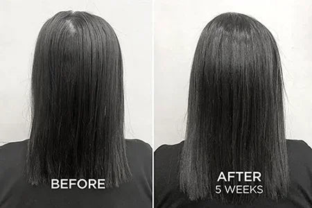 HWB Hair fall and hair growth before and after results