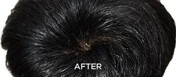 Stronger Roots, Reduced Fall