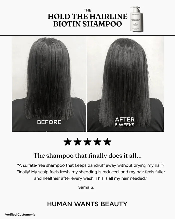 The Hold The Hairline Biotin Shampoo before and after testimonial: “The Shampoo That Finally Does It All…”