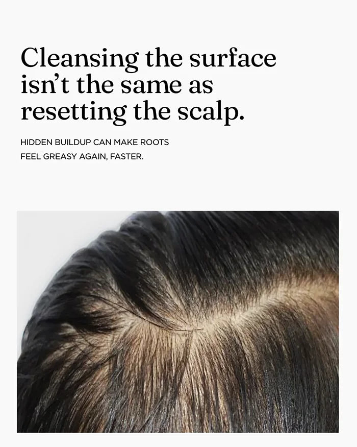 Scalp buildup can make roots feel greasy faster, showing why cleansing the surface isn't the same as a scalp reset
