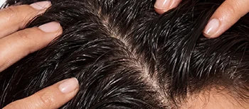 Root-Level Scalp Care