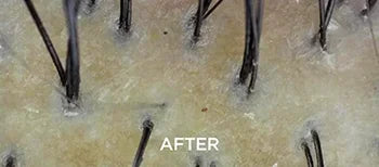 Deep-Down Scalp Reset