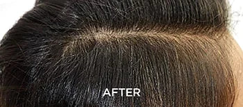 Root-Energizing Care